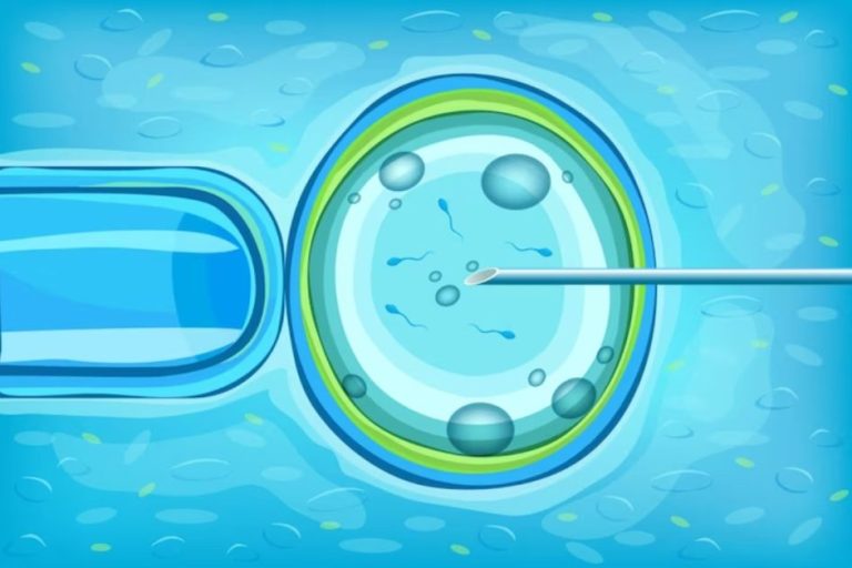 IVF treatment in Indore