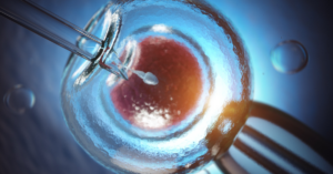 IVF (In Vitro Fertilization)